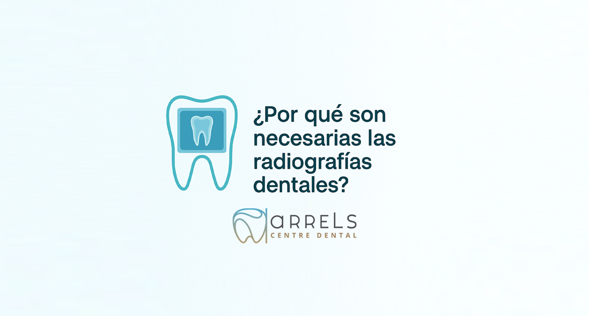 ¿Por qué son necesarias las radiografías dentales?